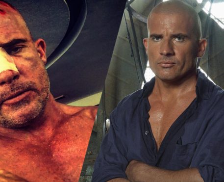 Dominic Purcell sofre grave acidente no set de Prison Break