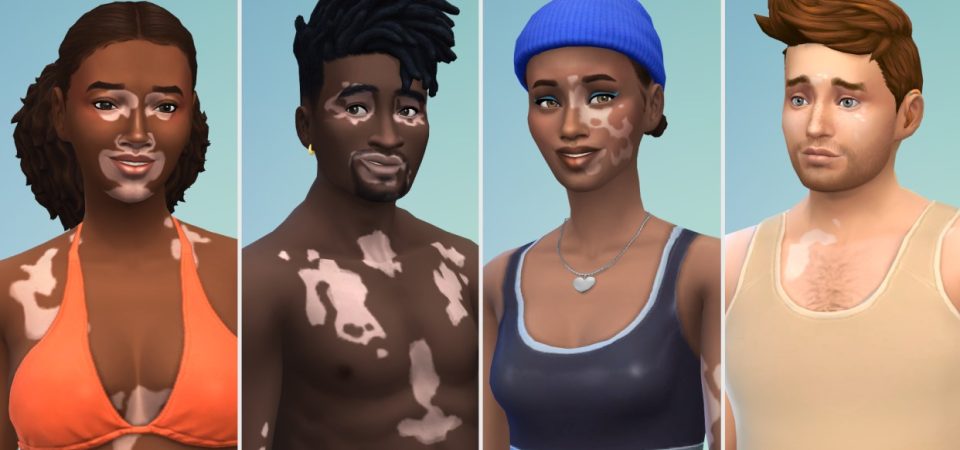 The Sims 4 - atualização Vitiligo