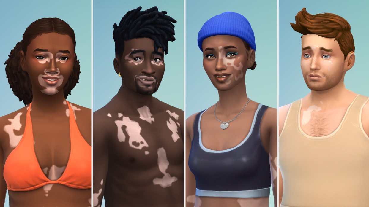 The Sims 4 - atualização Vitiligo